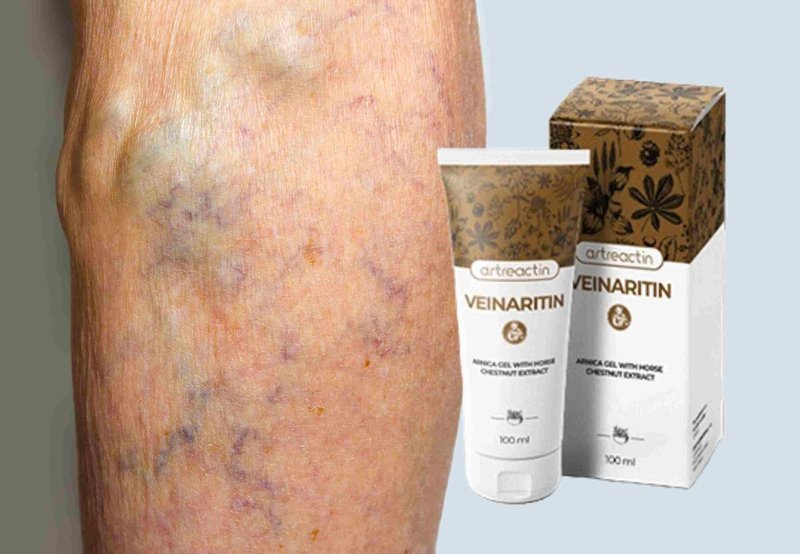 Czym jest Veinaritin i Jak Działa na Žylaki i Skórę